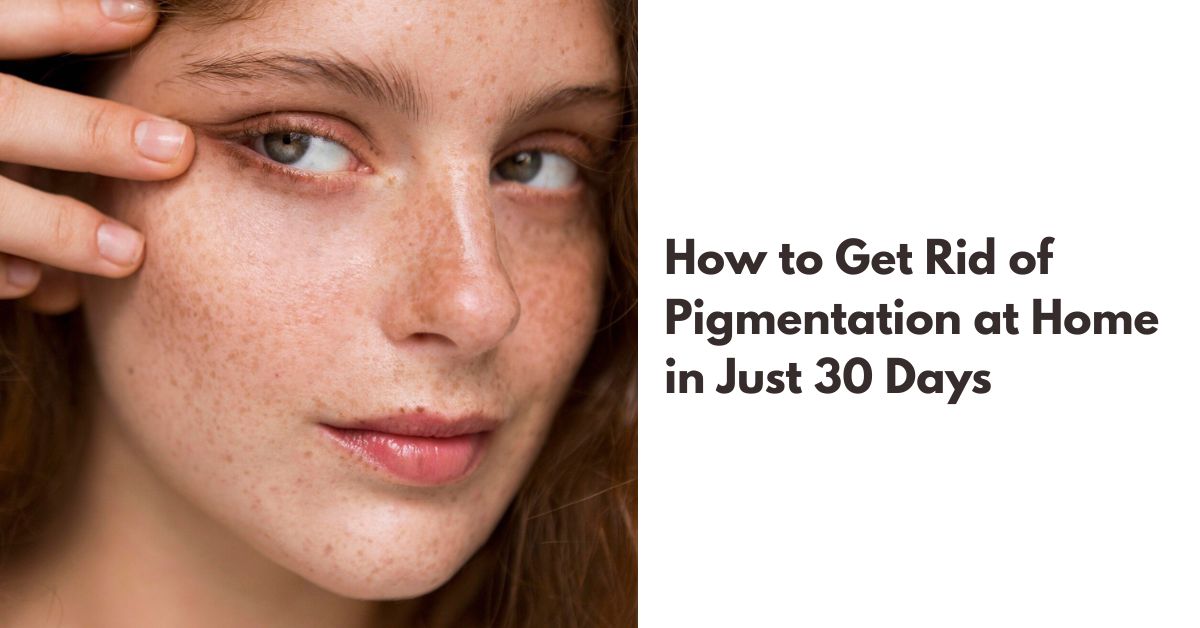 How to Get Rid of Pigmentation at Home in Just 30 Days