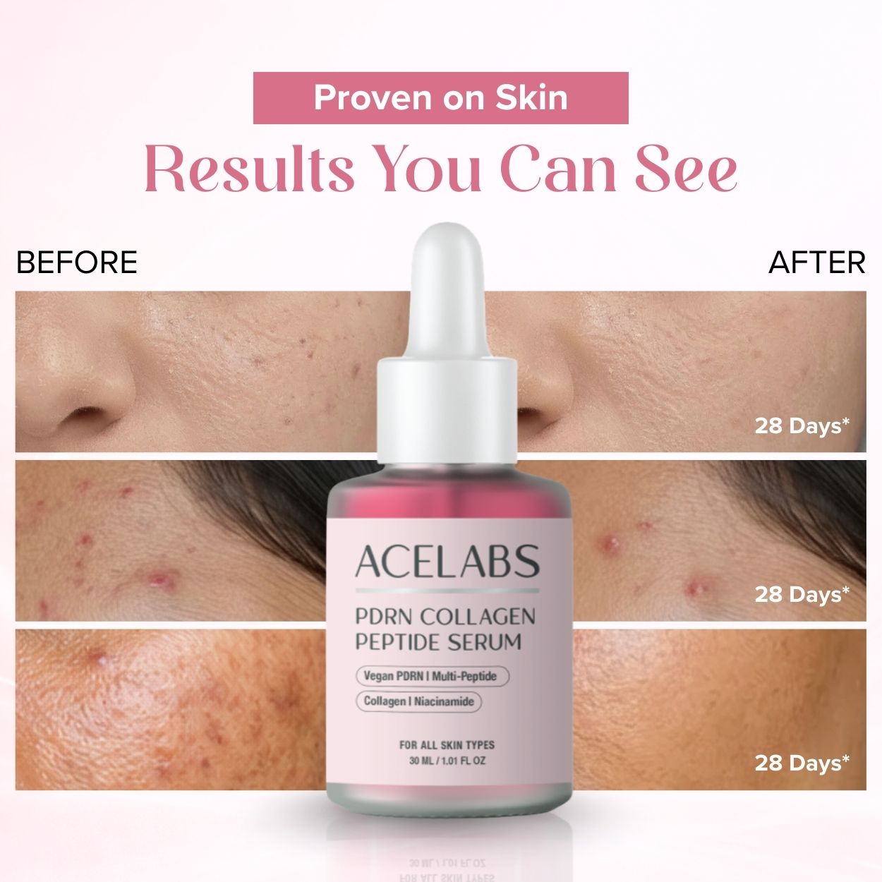 ACELABS PDRN Collagen Peptide Serum
