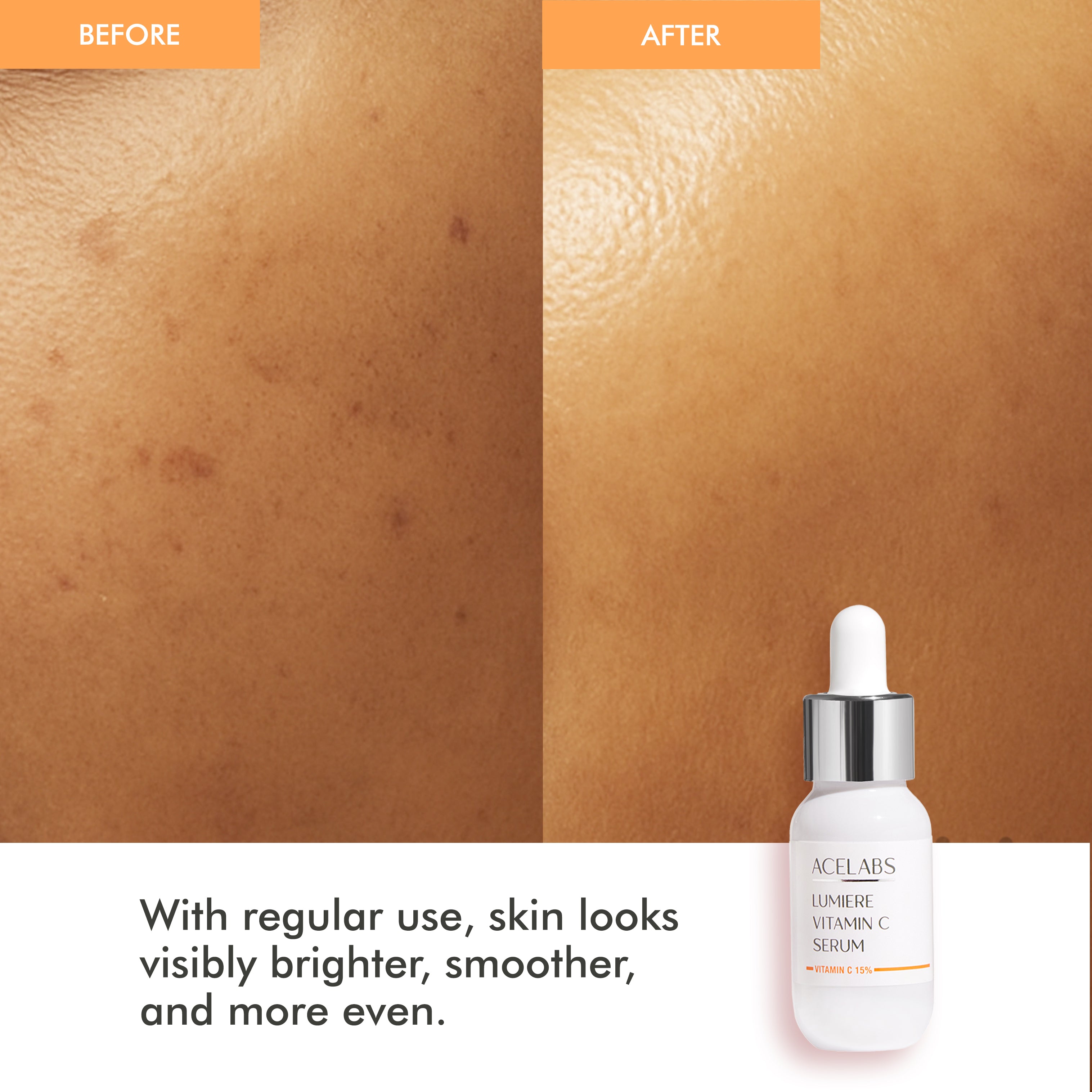 Lumiere 15% Vitamin C Face Serum – Fades Dark Spots & Boosts Glowing Skin