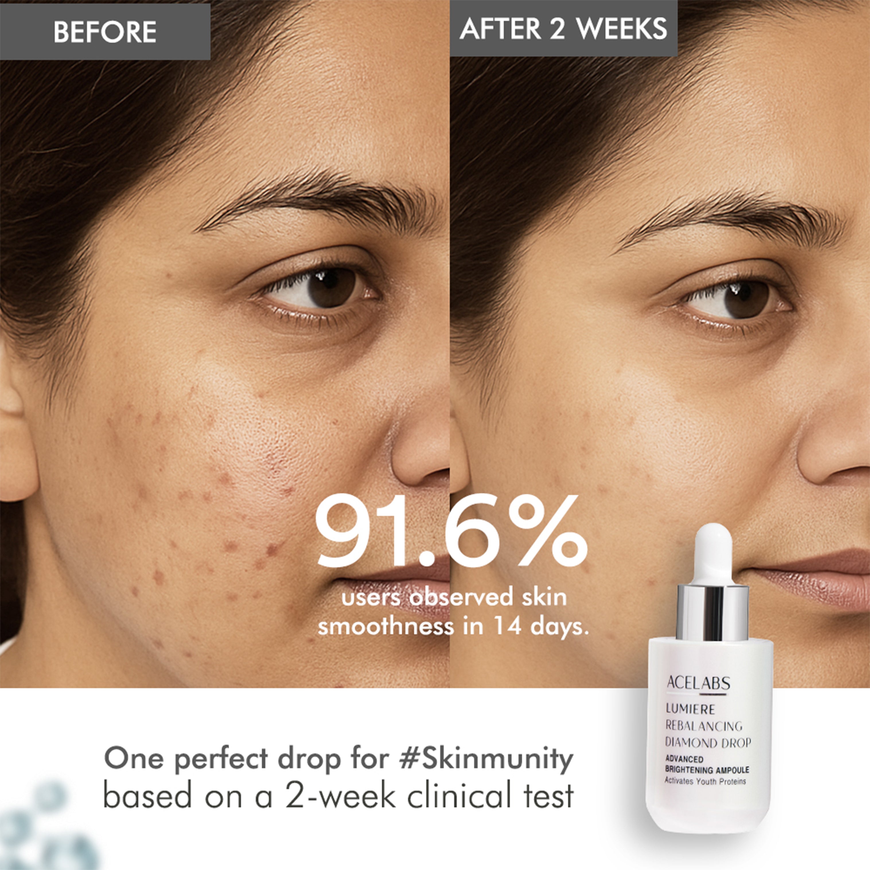 Before and after results of Lumiere Rebalancing Diamond Drop – 91.6% observed smoother skin in 2 weeks