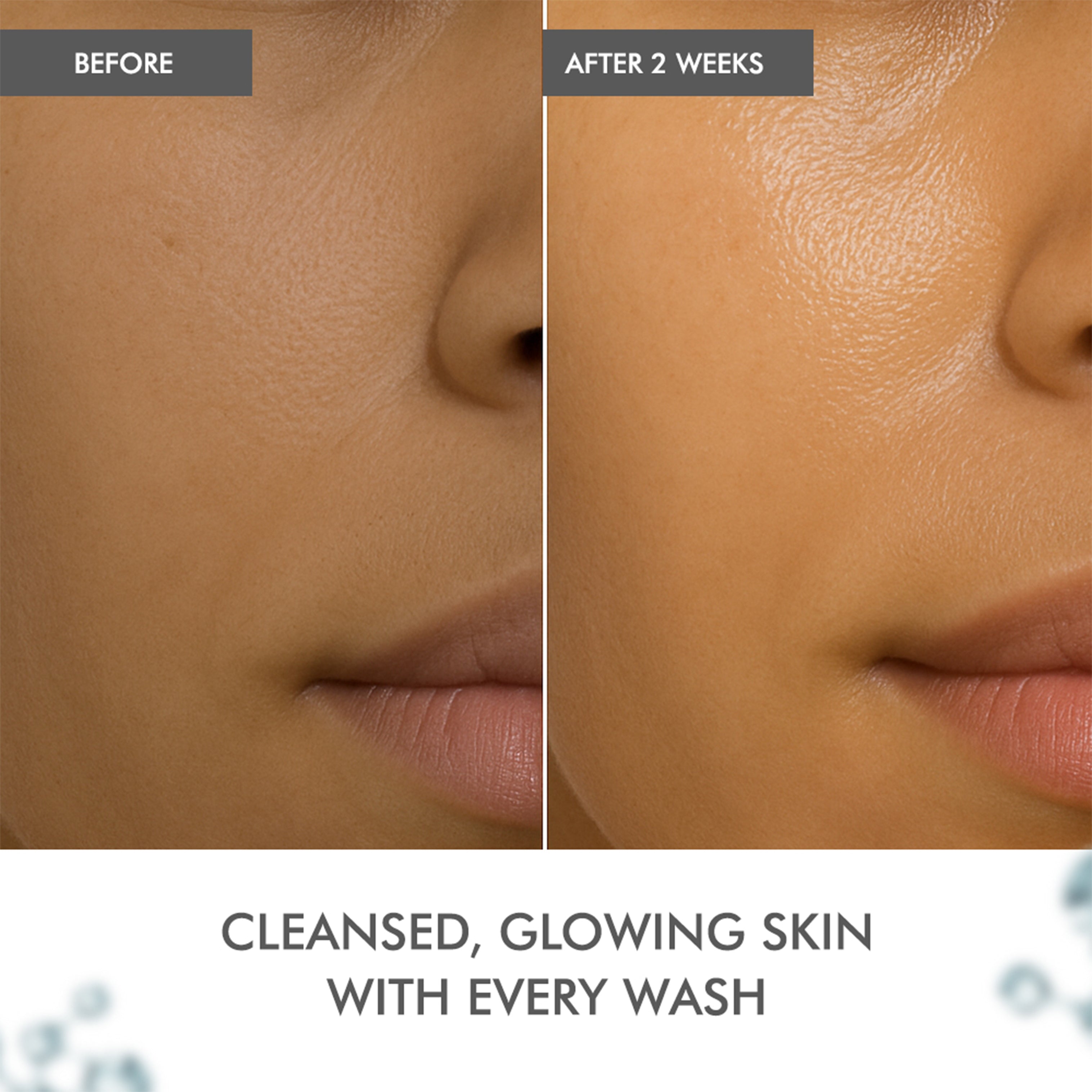 Before and after using Lumiere Low pH Diamond Essence Cleanser – visibly glowing and clean skin in 2 weeks