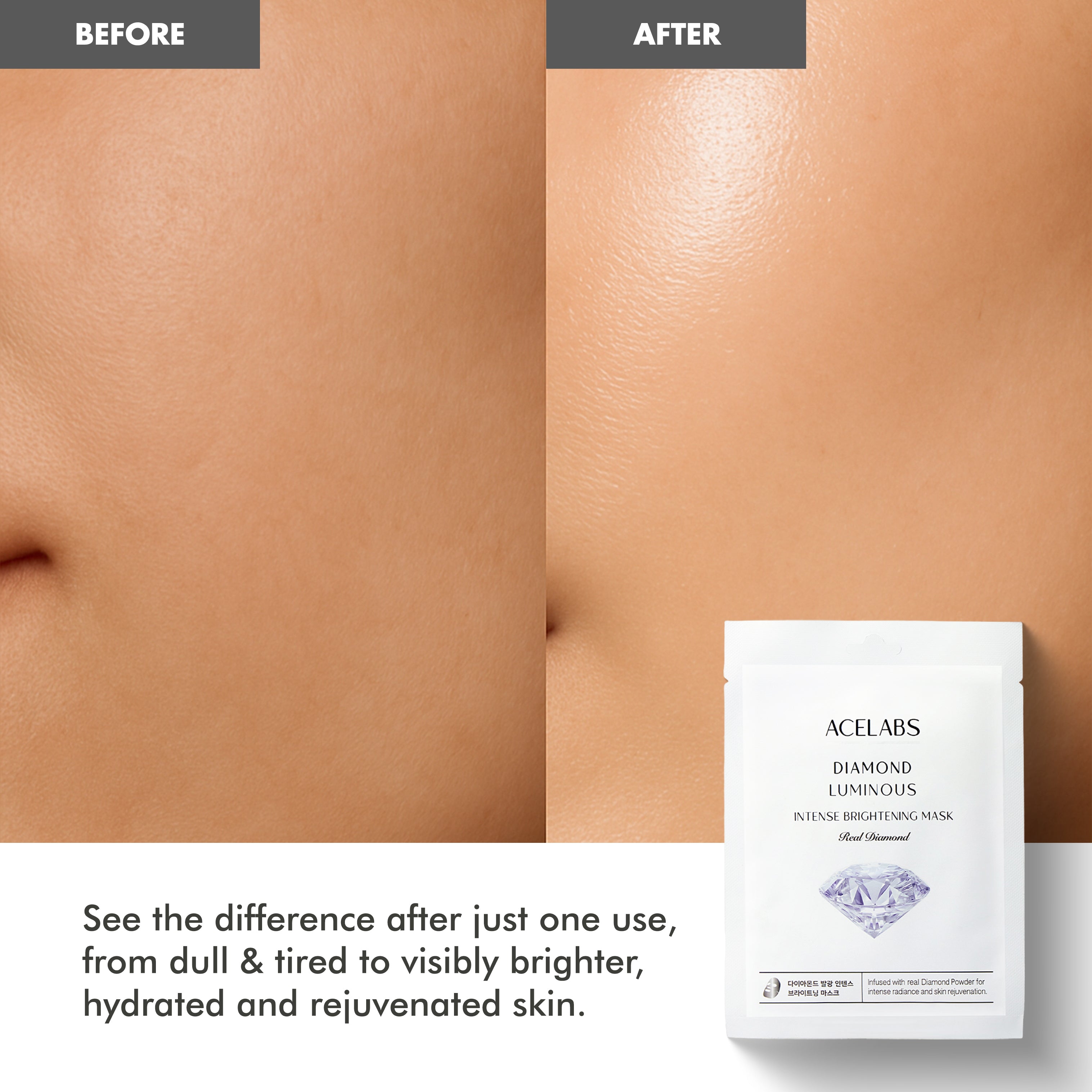 Face mask for pigmentation before and after – transforms dull, tired skin into bright and rejuvenated