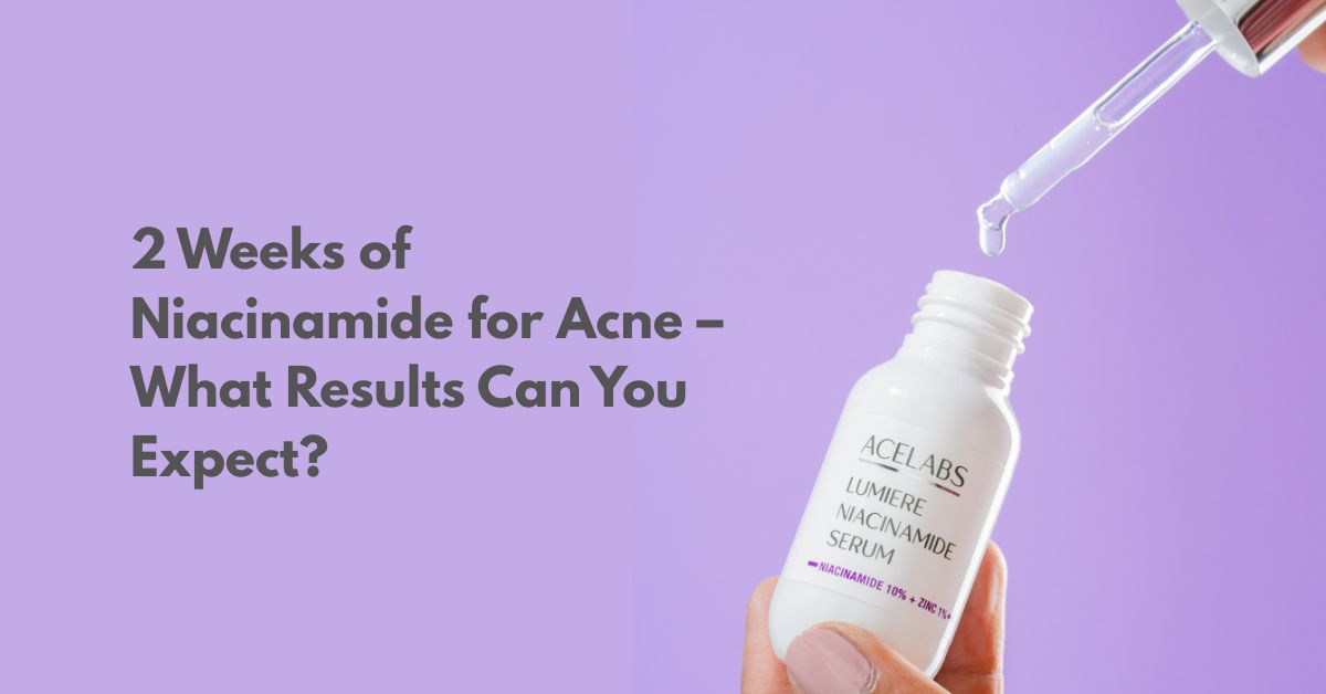Niacinamide for Acne: What Happens to Your Skin After 14 Days of Use?