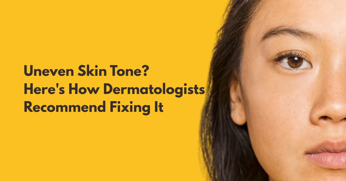 How to Fix Uneven Skin Tone: Dermatologist-Approved Steps That Work
