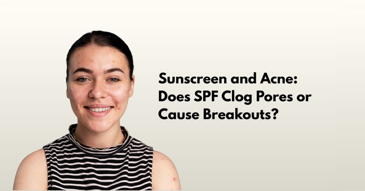 Can Sunscreen Cause Acne How to Choose the Right SPF
