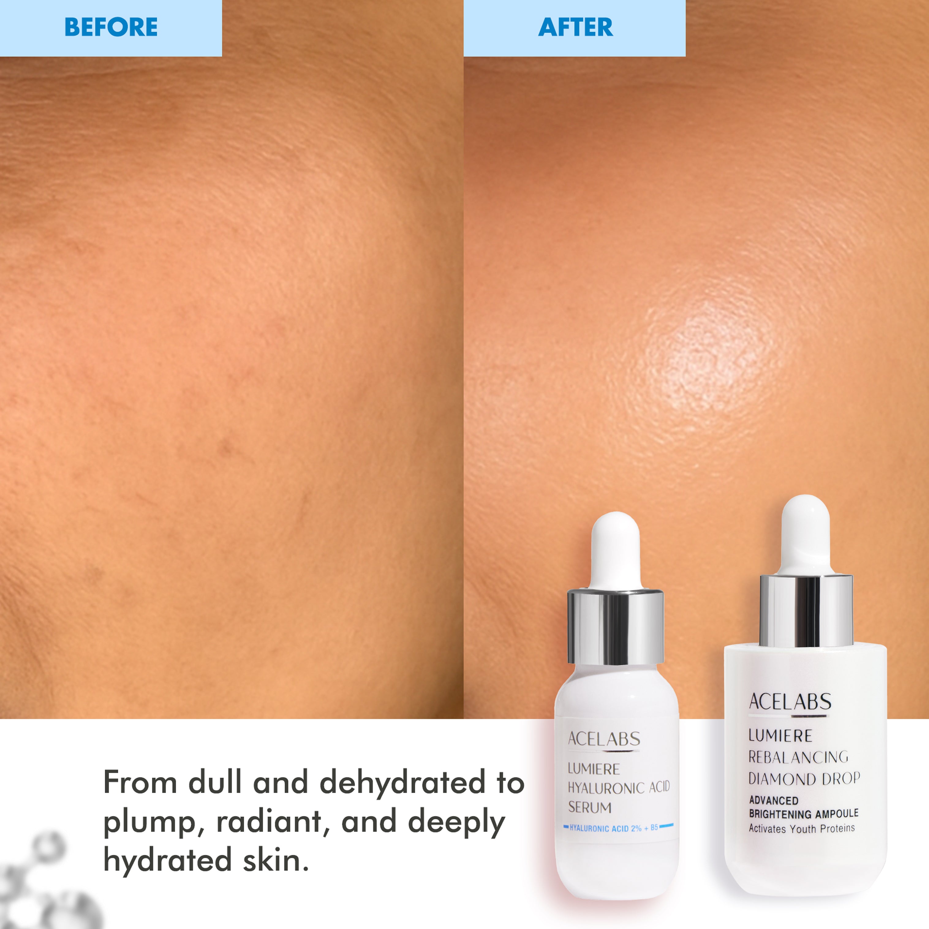 Intense Hydration Duo