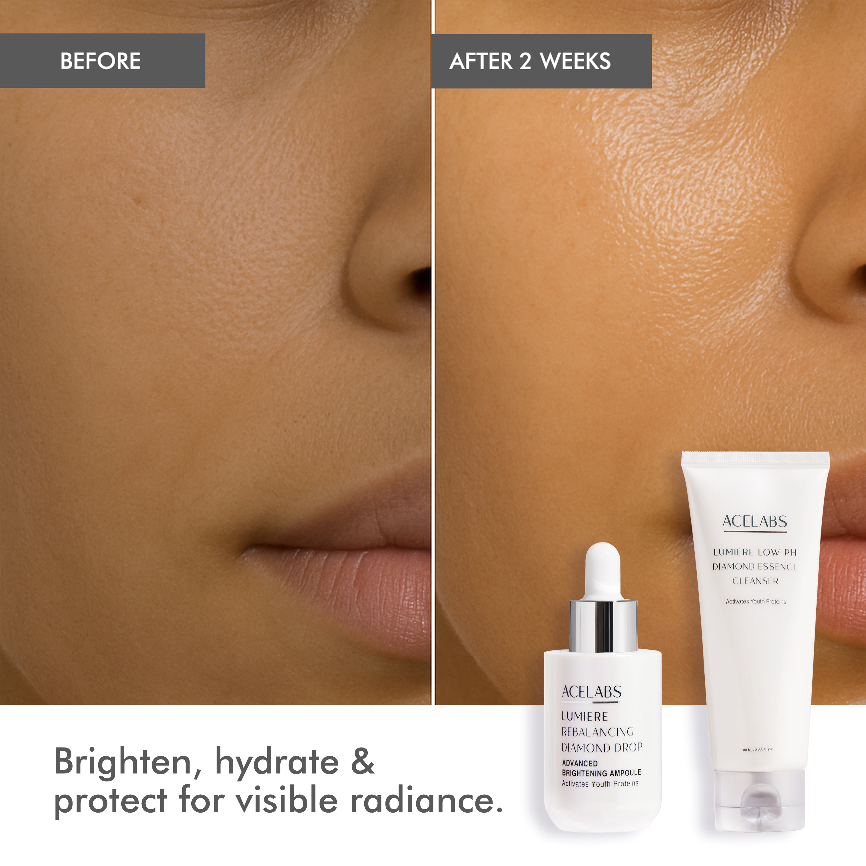 Before and after results of Acelabs Glass Skin Duo showing brighter, hydrated and radiant skin after two weeks