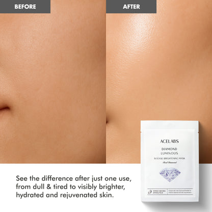 Face mask for pigmentation before and after – transforms dull, tired skin into bright and rejuvenated