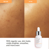 Vitamin C glow serum before and after – reduces dark spots, smoothens skin, and boosts radiance